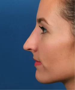 Profile view of a person with light skin and brown hair against a blue background.