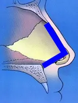 Illustration of a human nasal passage in side view, displaying anatomical structure with highlighted area in blue.