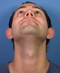 A person looks up with their head tilted back against a blue background, capturing their chin and neck in focus.