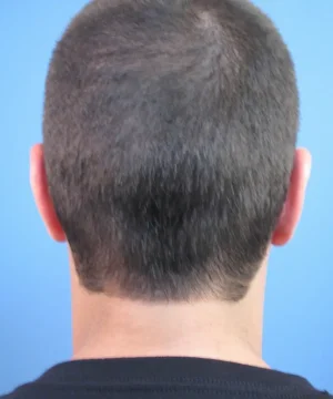 The back of a person's head with short brown hair against a blue background.