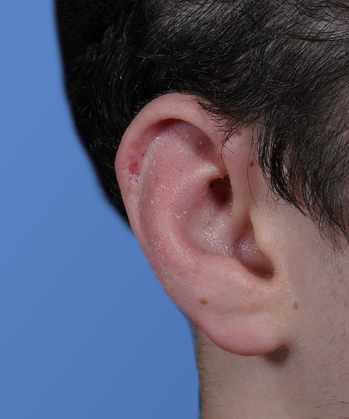 Close-up of a person's ear against a blue background.