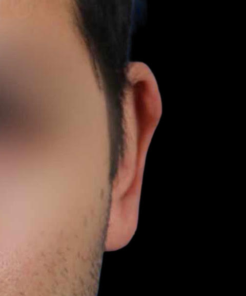 A close-up of the left side of a person's face, focusing on the ear against a black background.