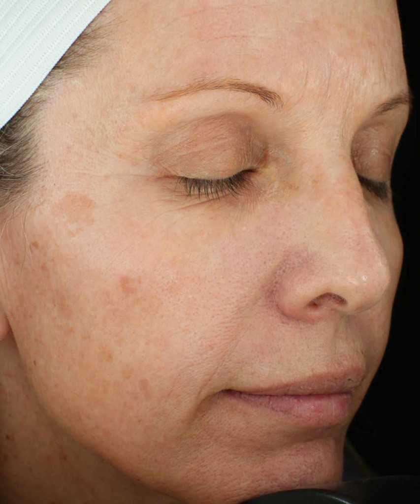 Close-up of a woman's face with closed eyes, showing visible age spots and fine lines. She wears a white headband.