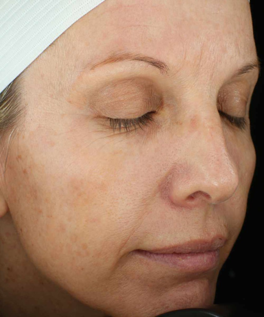 Close-up of a person's face with eyes closed, wearing a white headband, showing skin texture and light freckles.