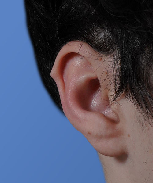 Close-up of a human ear against a plain blue background.